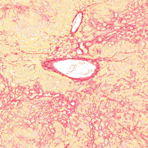 8841b7079345f5c3fdabb00340028b3b_1716287951147695.jpg 8841b7079345f5c3fdabb00340028b3b_1716287951147695.jpg